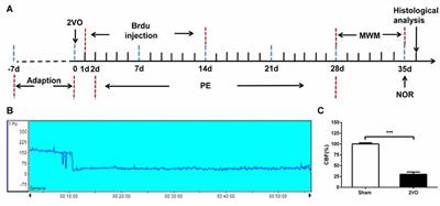 Physical Exercise Improves Cognitive Function Together with Microglia Phenotype Modulation and Remyelination in Chronic Cerebral Hypoperfusion